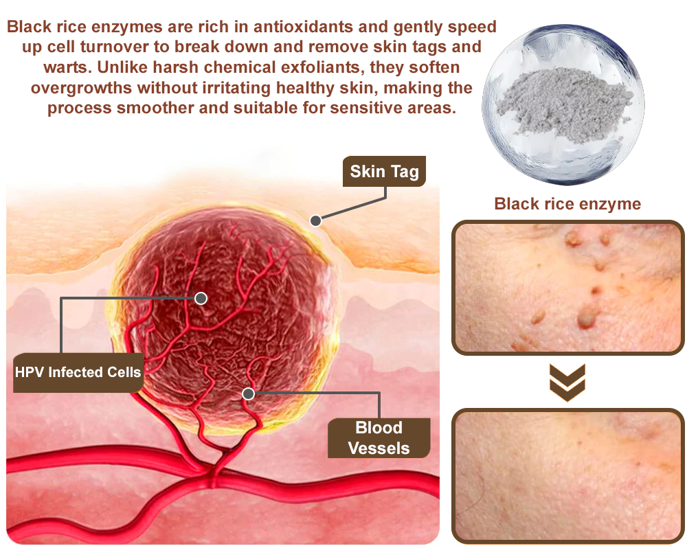 Zvoevo® Black Rice Skin Repair Cream 👨⚕️ FDA Approved (for removing warts, skin growths, scar repair)