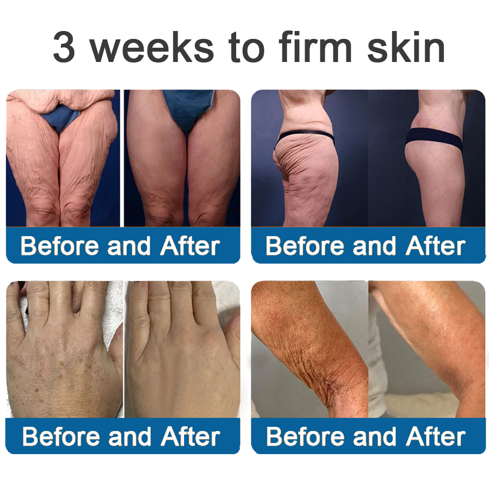 ✅Official Store: Zvoevo® Magnesium Skin Repair Cream (Smooths Wrinkles, Improves Skin Firmness, Tightens Skin)