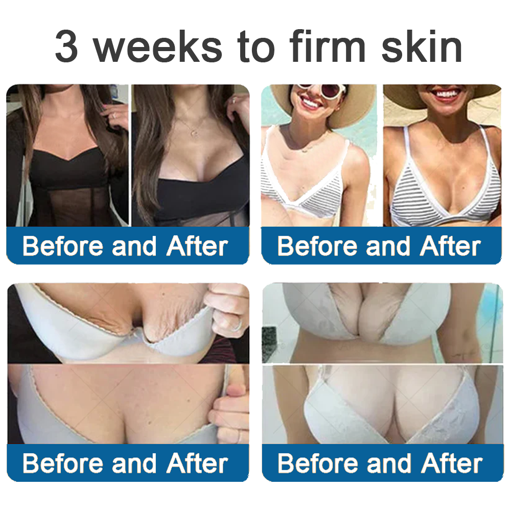 ✅Official Store: Zvoevo® Magnesium Skin Repair Cream (Smooths Wrinkles, Improves Skin Firmness, Tightens Skin)