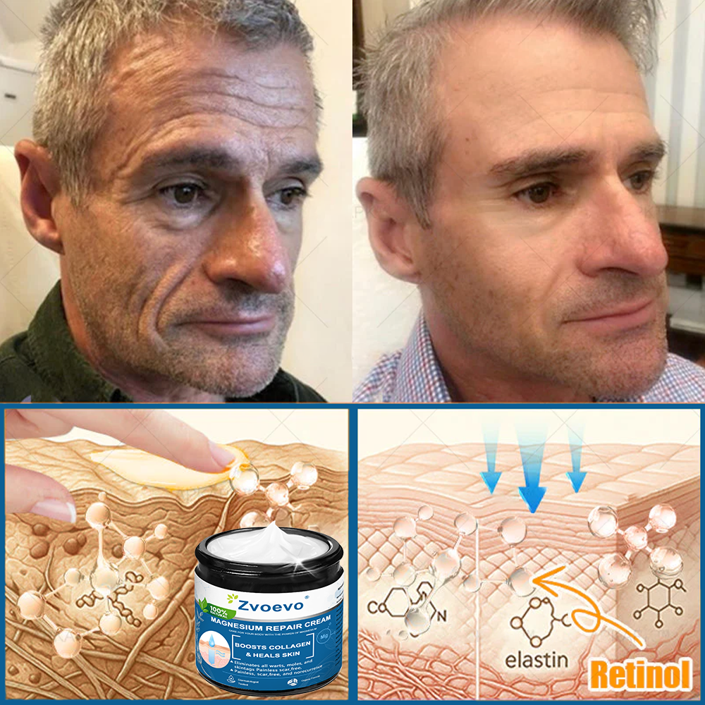 ✅Official Store: Zvoevo® Magnesium Skin Repair Cream (Smooths Wrinkles, Improves Skin Firmness, Tightens Skin)