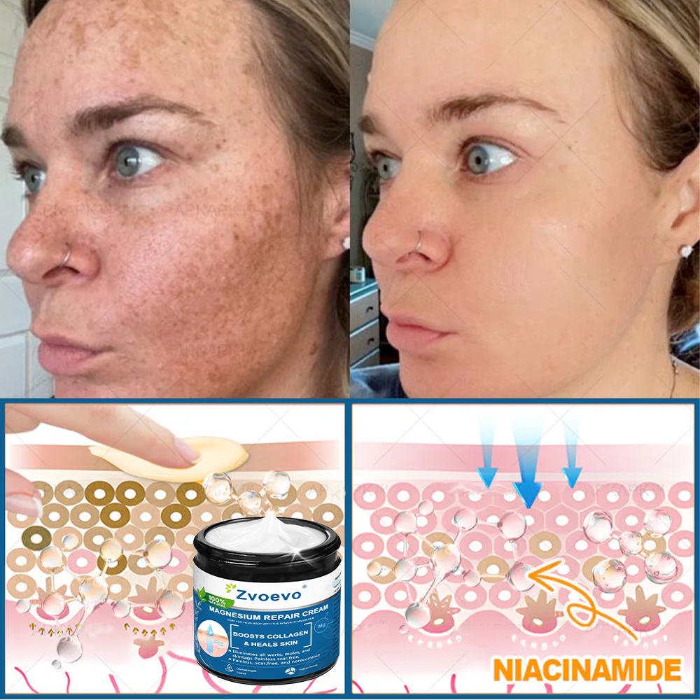 ✅Official Store: Zvoevo® Magnesium Skin Repair Cream (Smooths Wrinkles, Improves Skin Firmness, Tightens Skin)