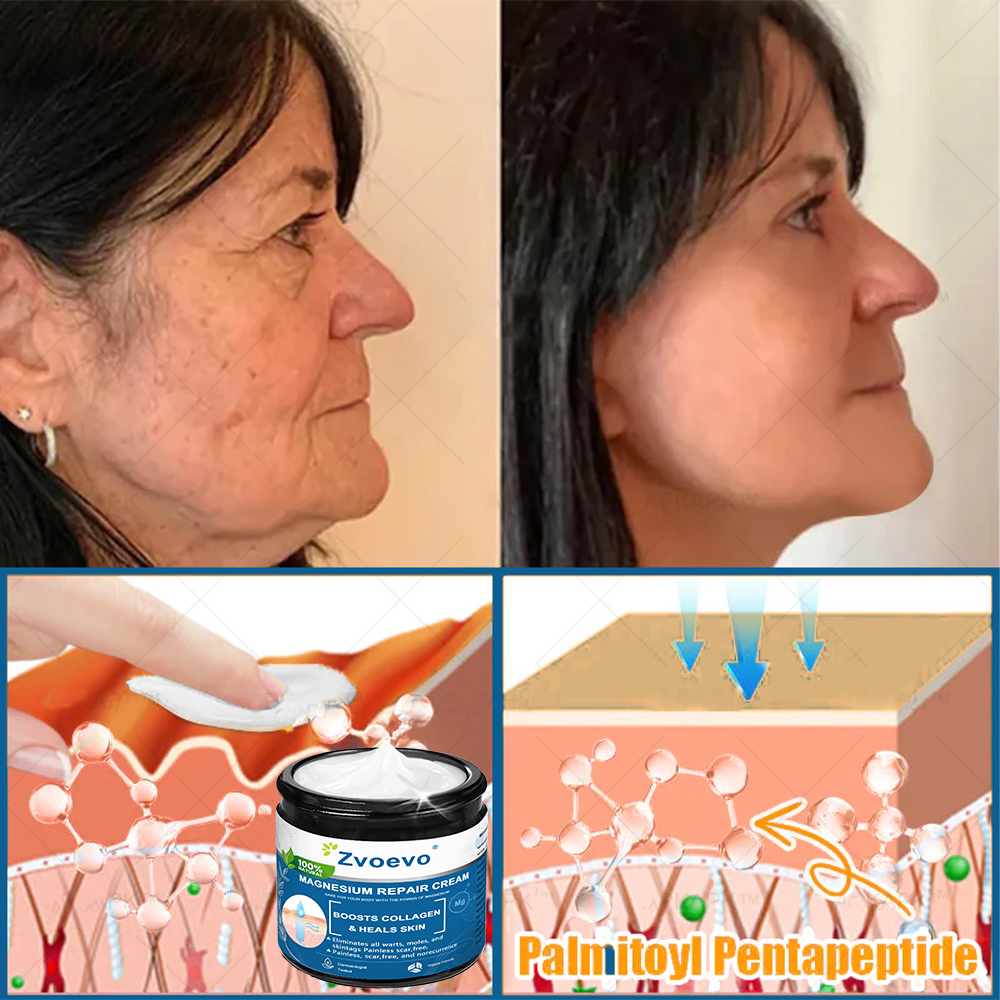 ✅Official Store: Zvoevo® Magnesium Skin Repair Cream (Smooths Wrinkles, Improves Skin Firmness, Tightens Skin)