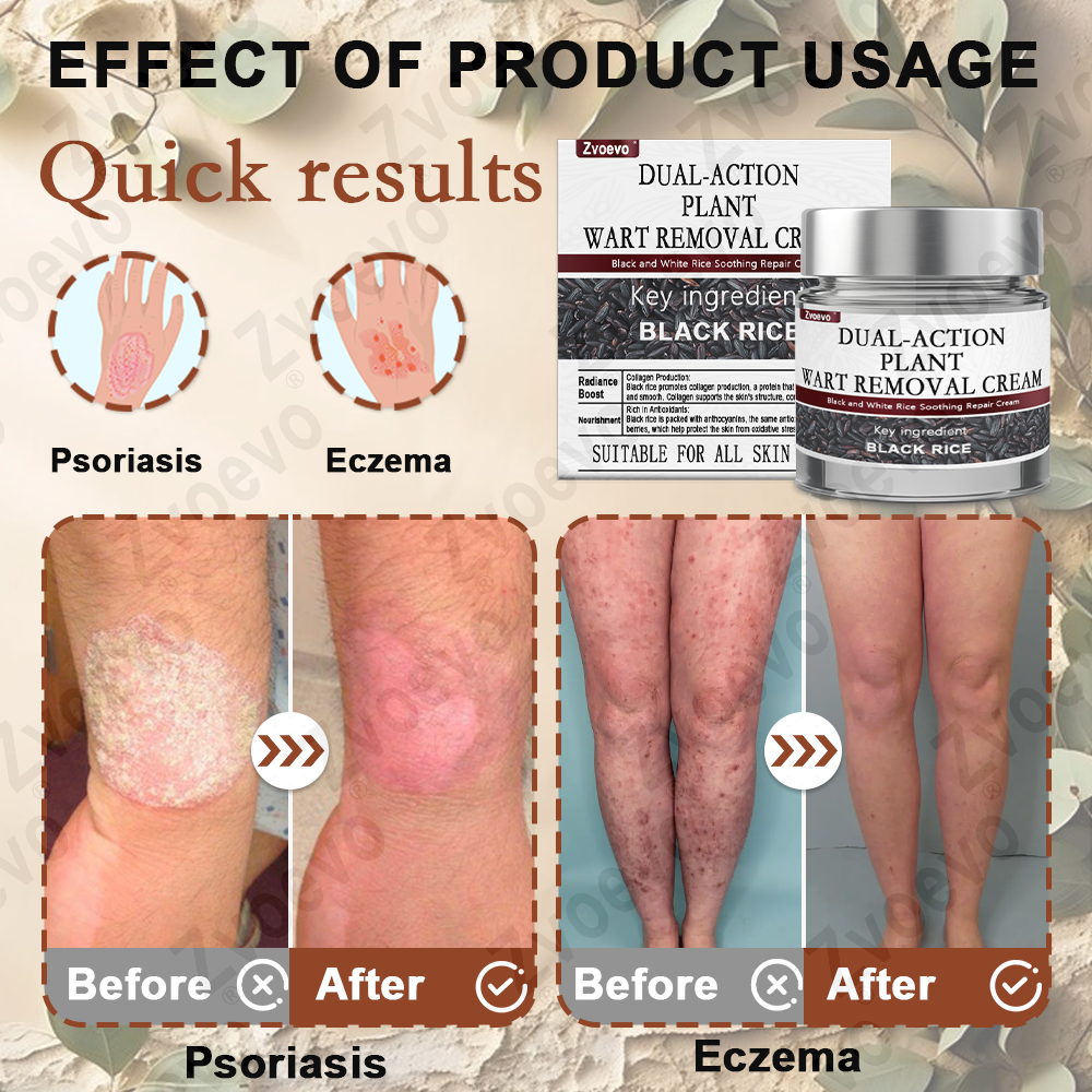 Zvoevo® Black Rice Skin Repair Cream 👨⚕️ FDA Approved (for removing warts, skin growths, scar repair)