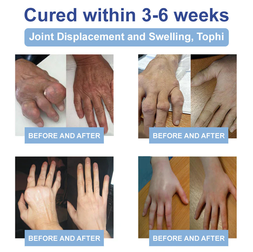 ✅FDA Certified : Rekulo® Black Rice Pain Healing Bone Cream ( Treatment for arthritis, neuropathyy, rheumatic diseases, sports injuries, twitches and muscle spasms)