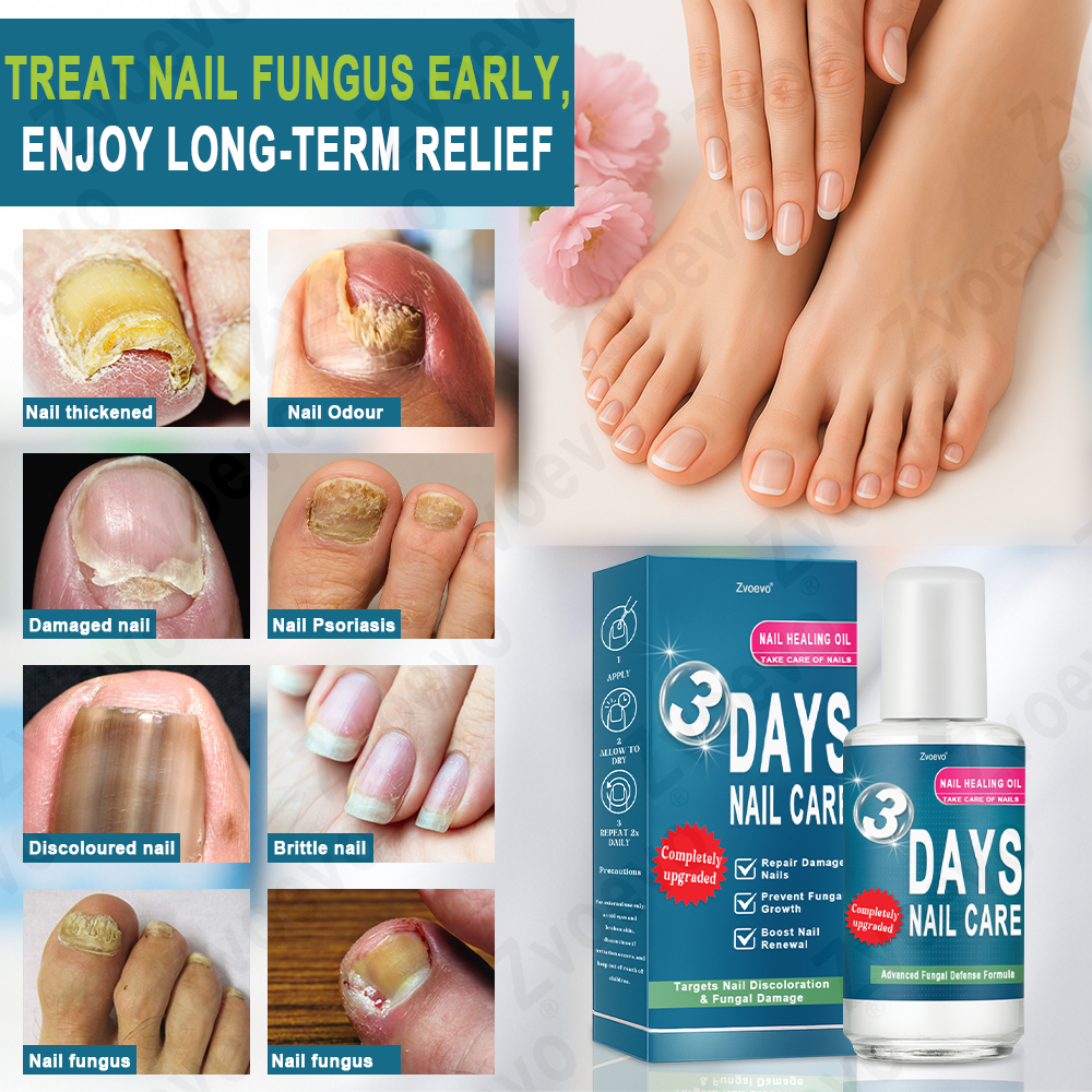 ✅ Official Store: Zvoevo® KERA3+ Nail Repair Serum👨‍⚕️FDA Approved (Antifungal solution for toenails and fingernails)