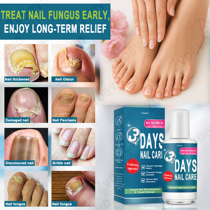 ✅ Official Store: Zvoevo® KERA3+ Nail Repair Serum👨‍⚕️FDA Approved (Antifungal solution for toenails and fingernails)