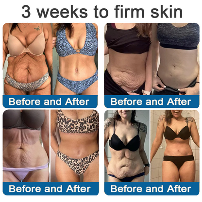 ✅Official Store: Zvoevo® Magnesium Skin Repair Cream (Smooths Wrinkles, Improves Skin Firmness, Tightens Skin)