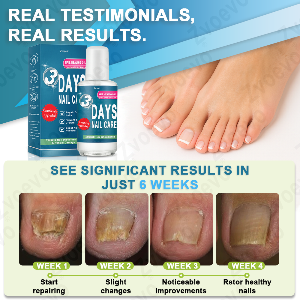 ✅ Official Store: Zvoevo® KERA3+ Nail Repair Serum👨‍⚕️FDA Approved (Antifungal solution for toenails and fingernails)