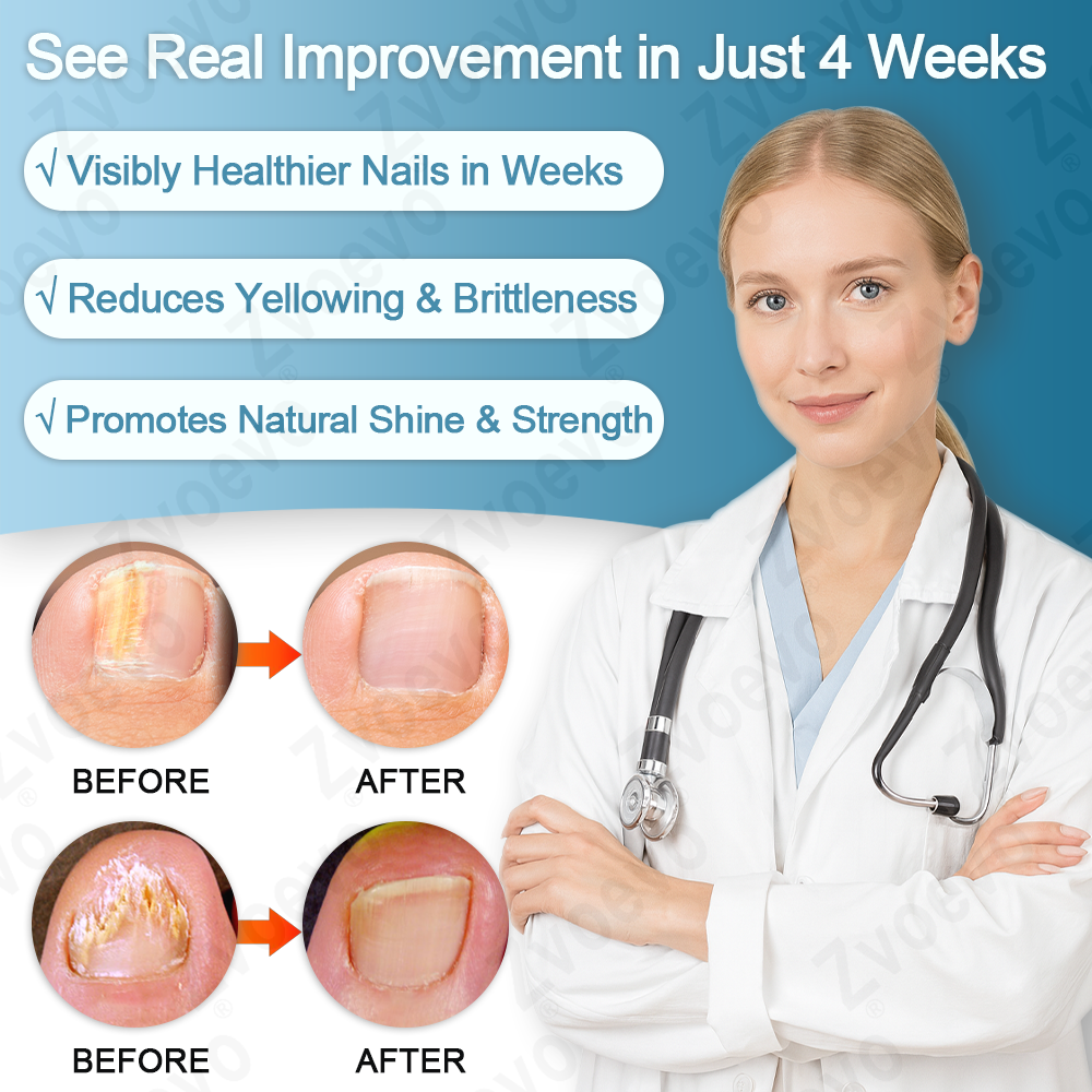 ✅ Official Store: Zvoevo® KERA3+ Nail Repair Serum👨‍⚕️FDA Approved (Antifungal solution for toenails and fingernails)