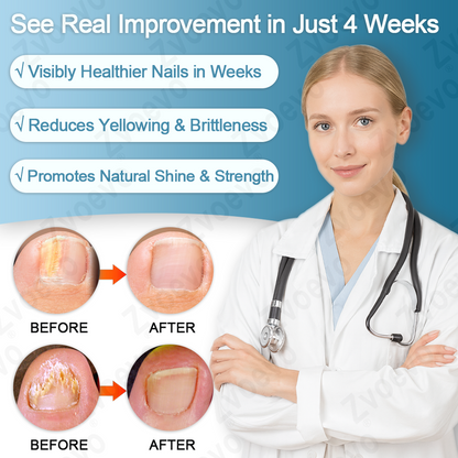 ✅ Official Store: Zvoevo® KERA3+ Nail Repair Serum👨‍⚕️FDA Approved (Antifungal solution for toenails and fingernails)