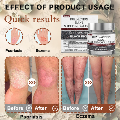 Zvoevo® Black Rice Skin Repair Cream 👨‍⚕️ FDA Approved (for removing warts, skin growths, scar repair, senile purpura)