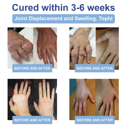 ✅FDA Certified :  Rekulo® Black Rice Pain Healing Bone Cream ( Treatment for arthritis, neuropathyy, rheumatic diseases, twitches and muscle spasms)