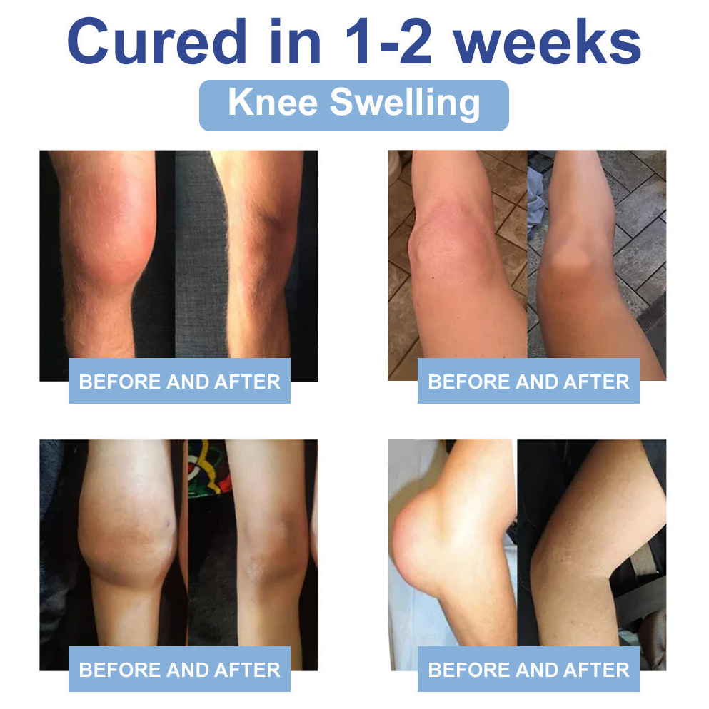 ✅FDA Certified :  Rekulo® Black Rice Pain Healing Bone Cream ( Treatment for arthritis, neuropathyy, rheumatic diseases, twitches and muscle spasms)